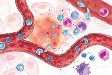 Efecto de la Boswellia en zonas inflamadas del cuerpo.